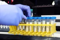 US FDA proposes standardized testing to detect asbestos in talc products